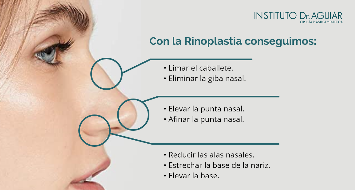 rinoplastia dudas frescuentes